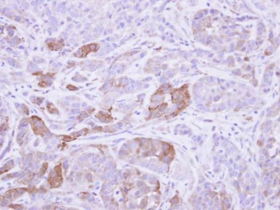 Immunohistochemistry (Formalin/PFA-fixed paraffin-embedded sections) - Anti-Villin antibody (AB97512)