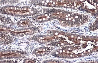 Immunohistochemistry (Formalin/PFA-fixed paraffin-embedded sections) - Anti-Villin antibody (AB97512)