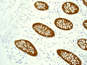 Immunohistochemistry (Formalin/PFA-fixed paraffin-embedded sections) - Anti-Villin antibody [EPR3491(3)] (AB133510)