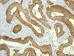 Anti-Villin antibody [EPR3491(3)] - BSA and Azide free
