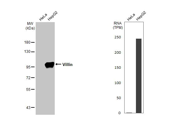 Western blot - Anti-Villin antibody [HL1830] (AB317112)