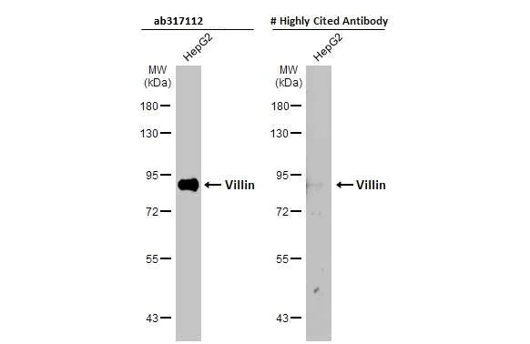Western blot - Anti-Villin antibody [HL1830] (AB317112)