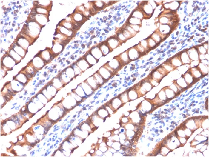 Immunohistochemistry (Formalin/PFA-fixed paraffin-embedded sections) - Anti-Villin antibody [rVIL1/1325] (AB268129)