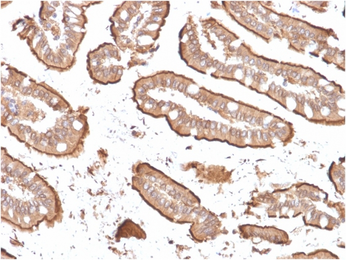 Immunohistochemistry (Formalin/PFA-fixed paraffin-embedded sections) - Anti-Villin antibody [rVIL1/1325] (AB268129)