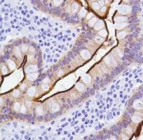 Immunohistochemistry (Formalin/PFA-fixed paraffin-embedded sections) - Anti-Villin antibody [SP145] (AB130751)