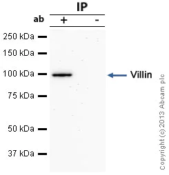 Immunoprecipitation - Anti-Villin antibody [SP145] - BSA and Azide free (AB245749)