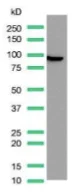 Western blot - Anti-Villin antibody [SP145] - BSA and Azide free (AB245749)