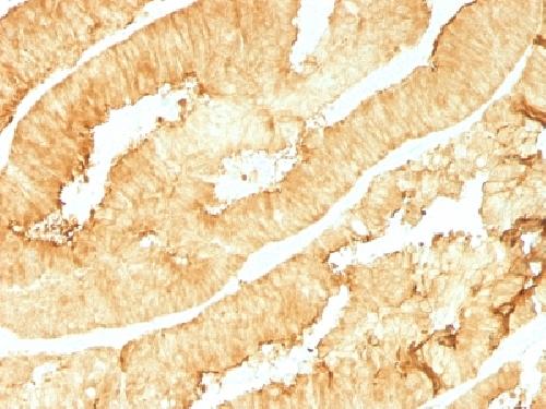 Immunohistochemistry (Formalin/PFA-fixed paraffin-embedded sections) - Anti-Villin antibody [VIL1/1314] (AB218331), expandable thumbnail