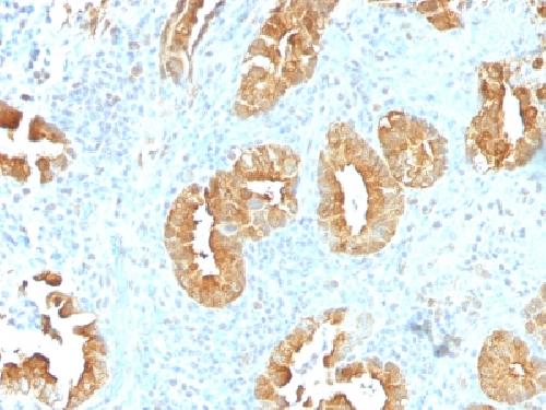 Immunohistochemistry (Formalin/PFA-fixed paraffin-embedded sections) - Anti-Villin antibody [VIL1/1314] (AB218331), expandable thumbnail