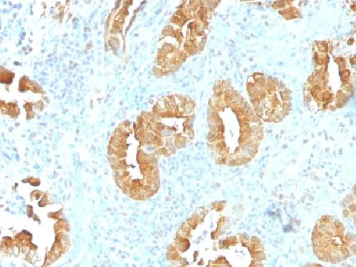 Immunohistochemistry (Formalin/PFA-fixed paraffin-embedded sections) - Anti-Villin antibody [VIL1/1314] (AB218331)