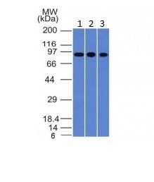 Western blot - Anti-Villin antibody [VIL1/1314] (AB218331), expandable thumbnail