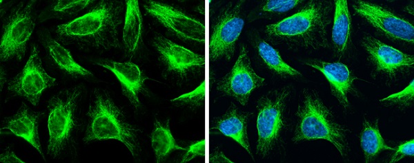 Immunocytochemistry/ Immunofluorescence - Anti-Vimentin antibody (ab137321), expandable thumbnail