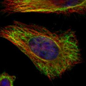 Immunocytochemistry/ Immunofluorescence - Anti-Vimentin antibody (ab137321), expandable thumbnail
