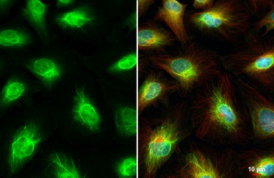 Immunocytochemistry/ Immunofluorescence - Anti-Vimentin antibody (ab137321), expandable thumbnail