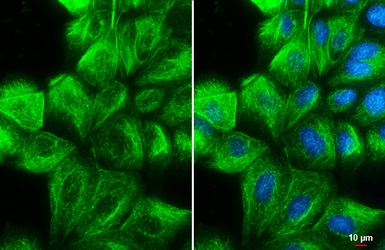 Immunocytochemistry/ Immunofluorescence - Anti-Vimentin antibody (ab137321), expandable thumbnail