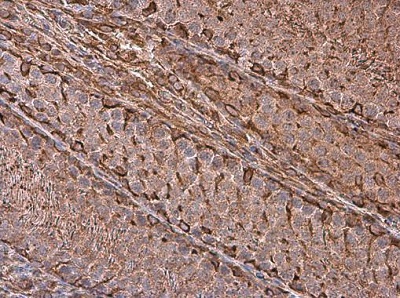 Immunohistochemistry (Formalin/PFA-fixed paraffin-embedded sections) - Anti-Vimentin antibody (AB137321), expandable thumbnail
