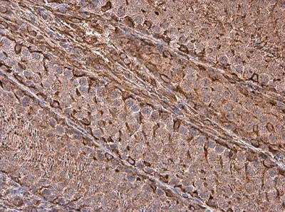 Immunohistochemistry (Formalin/PFA-fixed paraffin-embedded sections) - Anti-Vimentin antibody (AB137321)