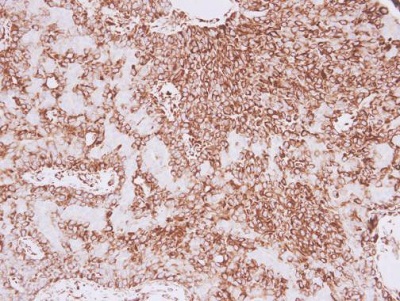 Immunohistochemistry (Formalin/PFA-fixed paraffin-embedded sections) - Anti-Vimentin antibody (AB137321), expandable thumbnail