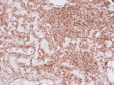 Immunohistochemistry (Formalin/PFA-fixed paraffin-embedded sections) - Anti-Vimentin antibody (AB137321)