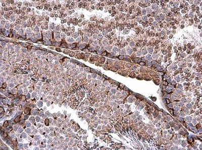 Immunohistochemistry (Formalin/PFA-fixed paraffin-embedded sections) - Anti-Vimentin antibody (ab137321), expandable thumbnail