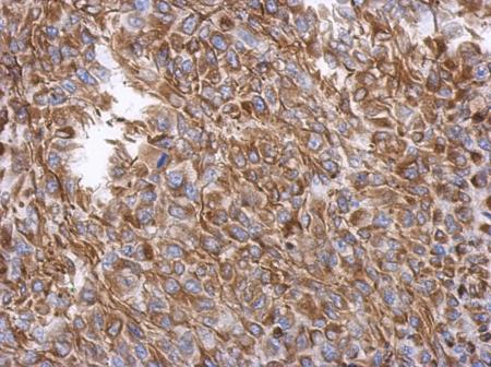 Immunohistochemistry (Formalin/PFA-fixed paraffin-embedded sections) - Anti-Vimentin antibody (ab137321), expandable thumbnail
