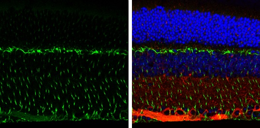 Immunohistochemistry (Formalin/PFA-fixed paraffin-embedded sections) - Anti-Vimentin antibody (AB137321), expandable thumbnail