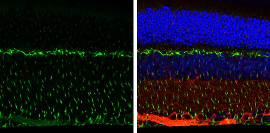 Immunohistochemistry (Formalin/PFA-fixed paraffin-embedded sections) - Anti-Vimentin antibody (AB137321)