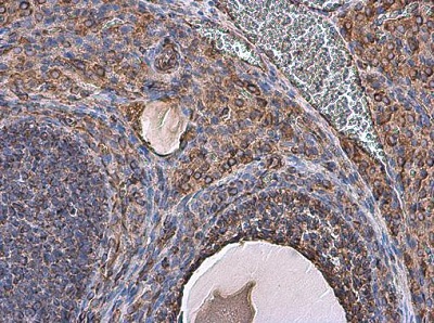 Immunohistochemistry (Formalin/PFA-fixed paraffin-embedded sections) - Anti-Vimentin antibody (ab137321), expandable thumbnail