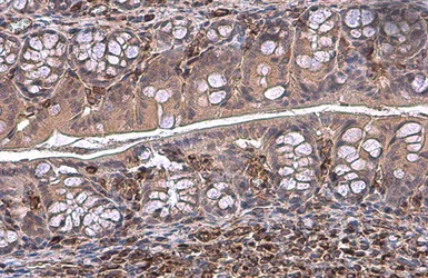 Immunohistochemistry (Formalin/PFA-fixed paraffin-embedded sections) - Anti-Vimentin antibody (AB137321)