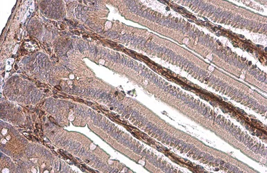 Immunohistochemistry (Formalin/PFA-fixed paraffin-embedded sections) - Anti-Vimentin antibody (AB137321)