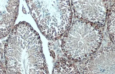 Immunohistochemistry (Formalin/PFA-fixed paraffin-embedded sections) - Anti-Vimentin antibody (AB137321)