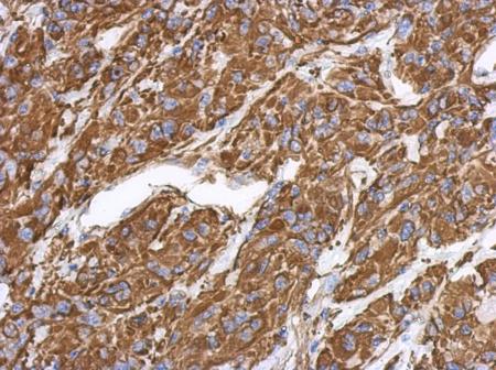 Immunohistochemistry (Formalin/PFA-fixed paraffin-embedded sections) - Anti-Vimentin antibody (ab137321), expandable thumbnail