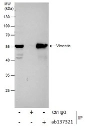 Immunoprecipitation - Anti-Vimentin antibody (ab137321), expandable thumbnail