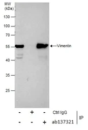 Immunoprecipitation - Anti-Vimentin antibody (AB137321)