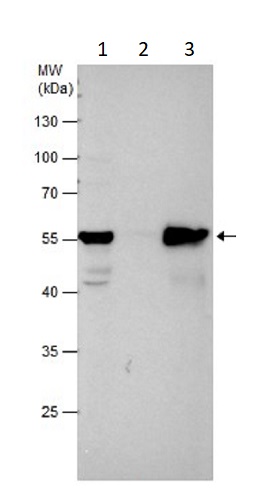 Immunoprecipitation - Anti-Vimentin antibody (AB137321), expandable thumbnail