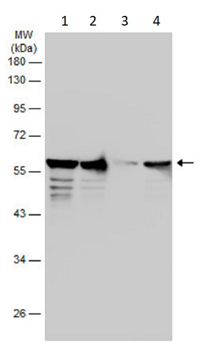 Western blot - Anti-Vimentin antibody (AB137321), expandable thumbnail