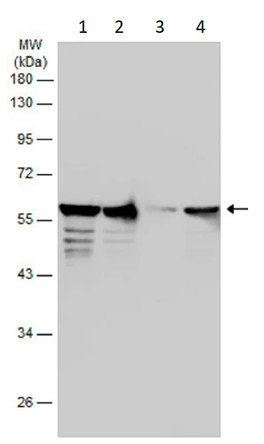 Western blot - Anti-Vimentin antibody (AB137321)