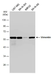 Western blot - Anti-Vimentin antibody (AB137321)