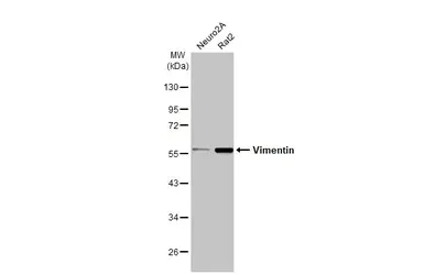 Western blot - Anti-Vimentin antibody (AB137321)