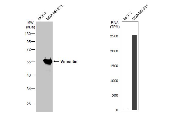 Anti-Vimentin antibody