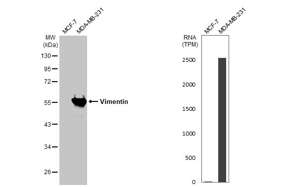 Western blot - Anti-Vimentin antibody (AB137321)