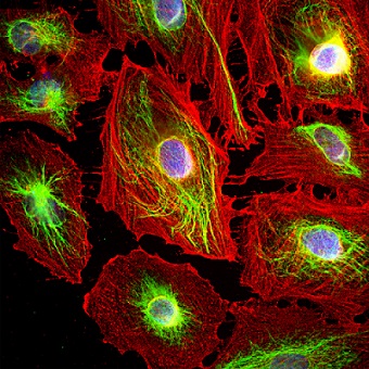 Immunocytochemistry/ Immunofluorescence - Anti-Vimentin antibody (AB188499), expandable thumbnail