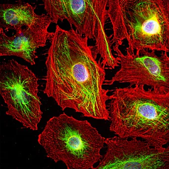 Immunocytochemistry/ Immunofluorescence - Anti-Vimentin antibody (AB188499)