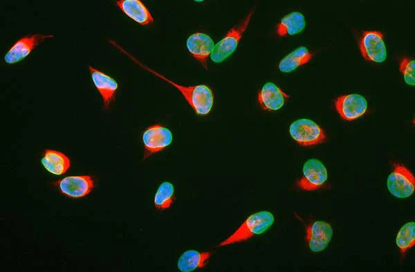 Immunocytochemistry/ Immunofluorescence - Anti-Vimentin antibody (AB188499)