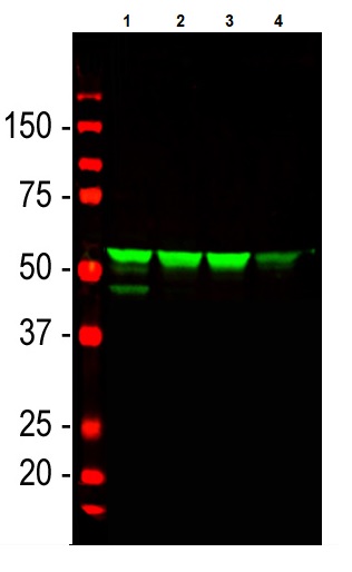 Western blot - Anti-Vimentin antibody (AB188499), expandable thumbnail