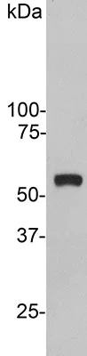 Western blot - Anti-Vimentin antibody (AB188499)