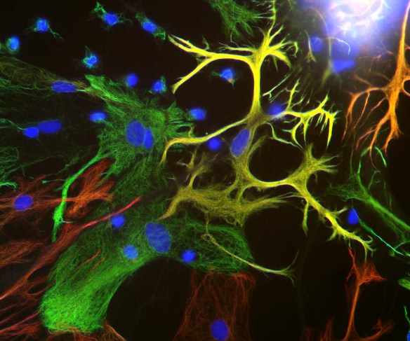 Immunocytochemistry/ Immunofluorescence - Anti-Vimentin antibody (AB24525), expandable thumbnail