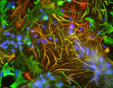 Immunocytochemistry/ Immunofluorescence - Anti-Vimentin antibody (AB24525), expandable thumbnail
