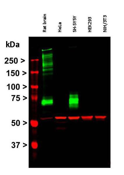 Western blot - Anti-Vimentin antibody (AB24525), expandable thumbnail