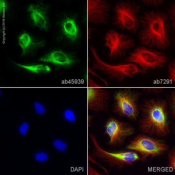Immunocytochemistry/ Immunofluorescence - Anti-Vimentin antibody - Cytoskeleton Marker (ab45939), expandable thumbnail
